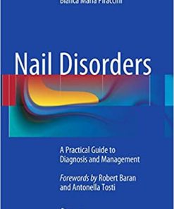 Nail Disorders A Practical Guide to Diagnosis and Management