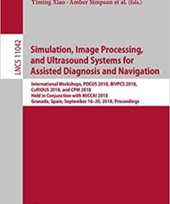 Simulation Image Processing and Ultrasound Systems for Assisted Diagnosis and Navigation