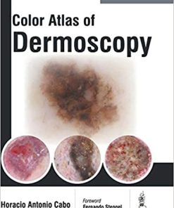 Colour Atlas of Dermoscopy