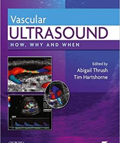 Vascular Ultrasound How Why and When 3rd Edition