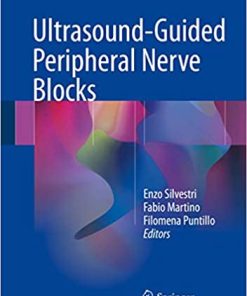 Ultrasound Guided Peripheral Nerve Blocks