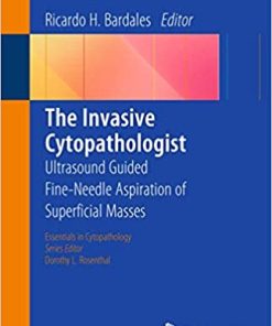 The Invasive Cytopathologist Ultrasound Guided Fine Needle Aspiration of Superficial Masses