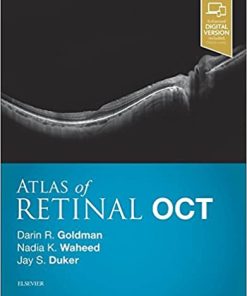 Atlas of Retinal OCT Optical Coherence Tomography