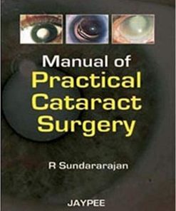 Manual of Practical Cataract Surgery
