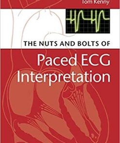 The Nuts and bolts of Paced ECG Interpretation