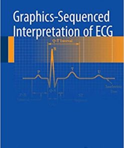 Graphics Sequenced interpretation of ECG