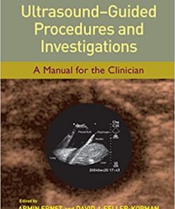 Ultrasound Guided Procedures and Investigations A Manual for the Clinician