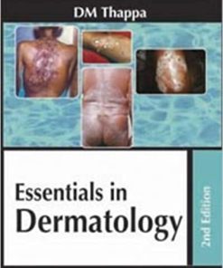 Essentials in Dermatology 2nd Edition