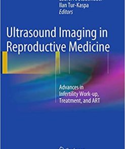 Ultrasound Imaging in Reproductive Medicine Advances in Infertility Work Up Treatment and Art 2nd Edition