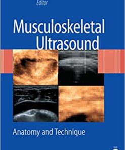 Musculoskeletal Ultrasound Anatomy and Technique