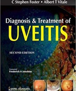 Diagnosis and Treatment of Uveitis
