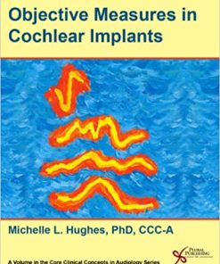 Objective Measures in Cochlear Implants