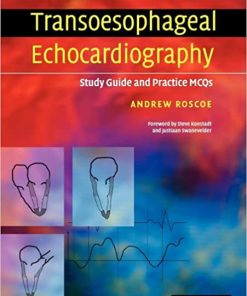 Transoesophageal Echocardiography Study Guide and Practice MCQs