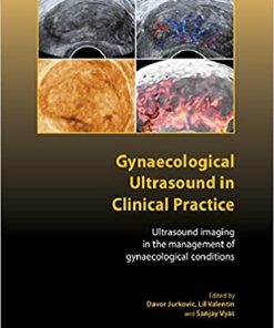 Gynaecological Ultrasound in Clinical Practice Ultrasound Imaging in the Management of Gynaecological Conditions