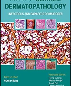 Atlas of Clinical Dermatopathology Infectious and Parasitic Dermatoses