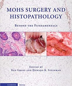 Mohs Surgery and Histopathology Beyond the Fundamentals