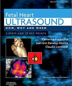 Fetal Heart Ultrasound How Why and When