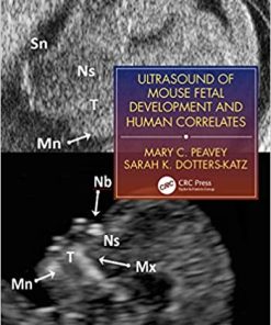 Ultrasound of Mouse Fetal Development and Human Correlates