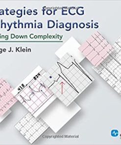 Strategies for ECG Arrhythmia Diagnosis Breaking Down Complexity