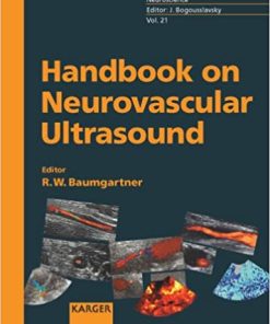 Handbook on Neurovascular Ultrasound