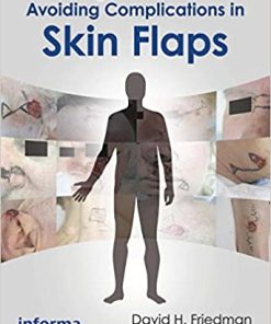 Making Decisions and Avoiding Complications in Skin Flaps