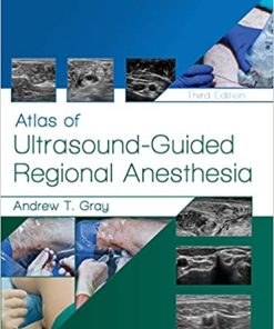 Atlas of Ultrasound Guided Regional Anesthesia 3rd Edition