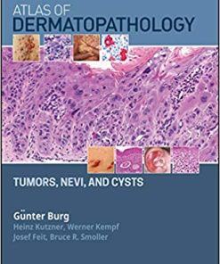 Atlas of Dermatopathology Tumors Nevi and Cysts