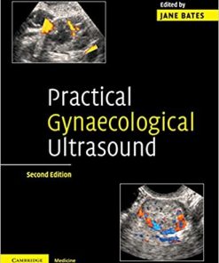 Practical Gynaecological Ultrasound