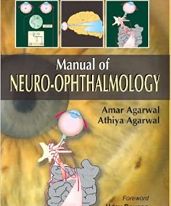 Manual of Neuro Ophthalmogy