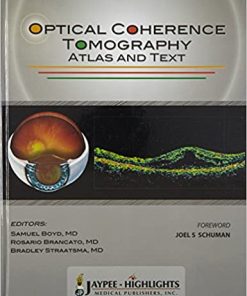 Optical Coherence Tomography Atlas and Text