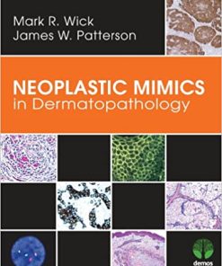 Neoplastic Mimics in Dermatopathology