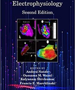 Handbook of Cardiac Electrophysiology 2nd Edition