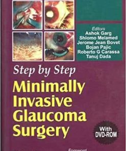 Step by Step Minimally Invasive Cataract Surgery