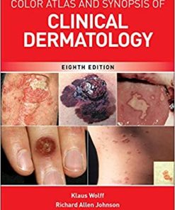 Fitzpatricks Color Atlas And Synopsis Of Clinical Dermatology 8th Ed