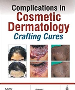 Complications in Cosmetic Dermatology Crafting Cures