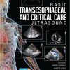 Basic Transesophageal and Critical Care Ultrasound