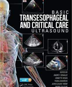 Basic Transesophageal and Critical Care Ultrasound