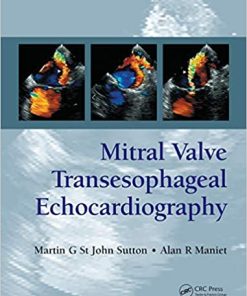 Mitral Valve Transesophageal Echocardiography