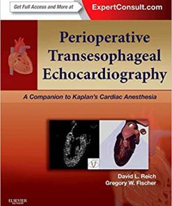 Perioperative Transesophageal Echocardiography A Companion to Kaplans Cardiac Anesthesia