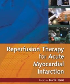 Reperfusion Therapy for Acute Myocardial Infarction
