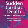 Pathology of Sudden Cardiac Death An Illustrated Guide