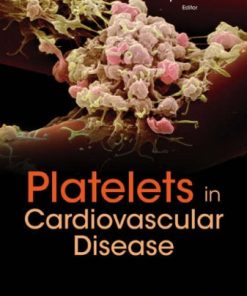 Platelets in Cardiovascular Disease