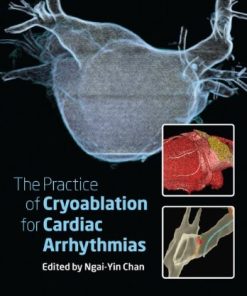 The Practice of Catheter Cryoablation for Cardiac Arrhythmias