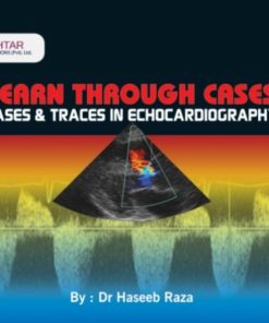 Learn Through Cases & Traces in Echocardiography By Dr Haseeb Raza