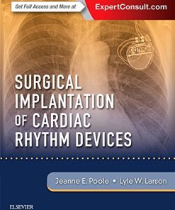 Surgical Implantation of Cardiac Rhythm Devices