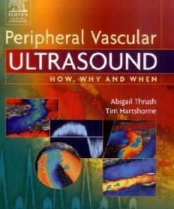Peripheral Vascular Ultrasound How Why and When 2nd Edition