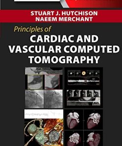 Principles of Cardiac and Vascular Computed Tomography