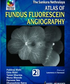 The Sankara Nethralaya Atlas of Fundus Fluorescein Angiography 2nd Ed