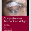 Comprehensive Textbook on Vitiligo