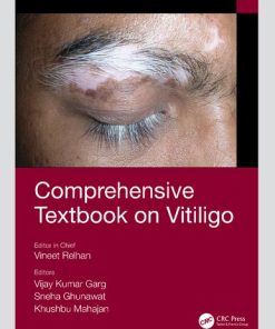 Comprehensive Textbook on Vitiligo